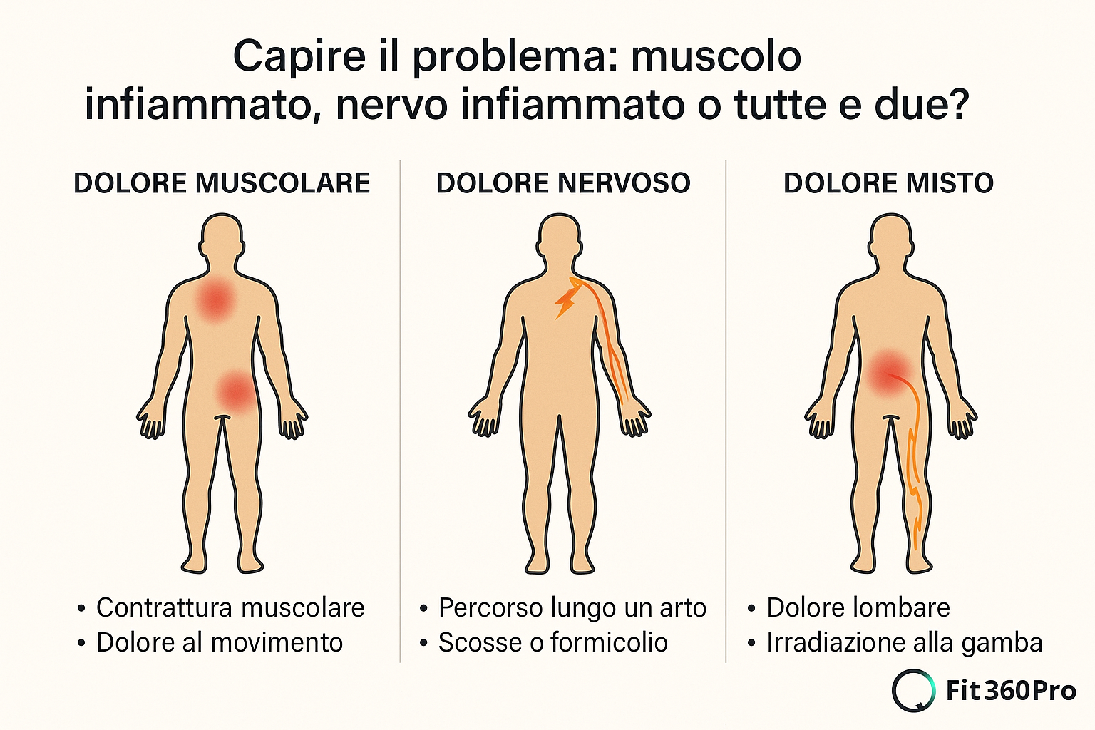 Schema comparativo dei diversi tipi di dolore a muscoli e nervi con esempi di dolore muscolare, dolore nervoso e dolore misto – Fit360Pro